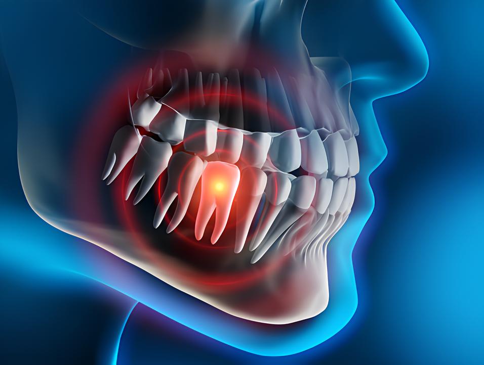 Teeth image - Emergency dentist Great Yarmouth